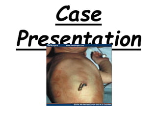 Case
Presentation
 