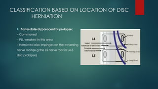 Disc Prolapse Classification CASE PRESENTATION OF LOW BACK AND CLINICAL EXAMINATION PAIN.pptx