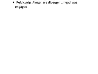  Pelvic grip :Finger are divergent, head was
engaged
 