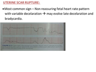UTERINE SCAR RUPTURE:
Most common sign – Non reassuring fetal heart rate pattern
with variable decelaration  may evolve late decelaration and
bradycardia.
 