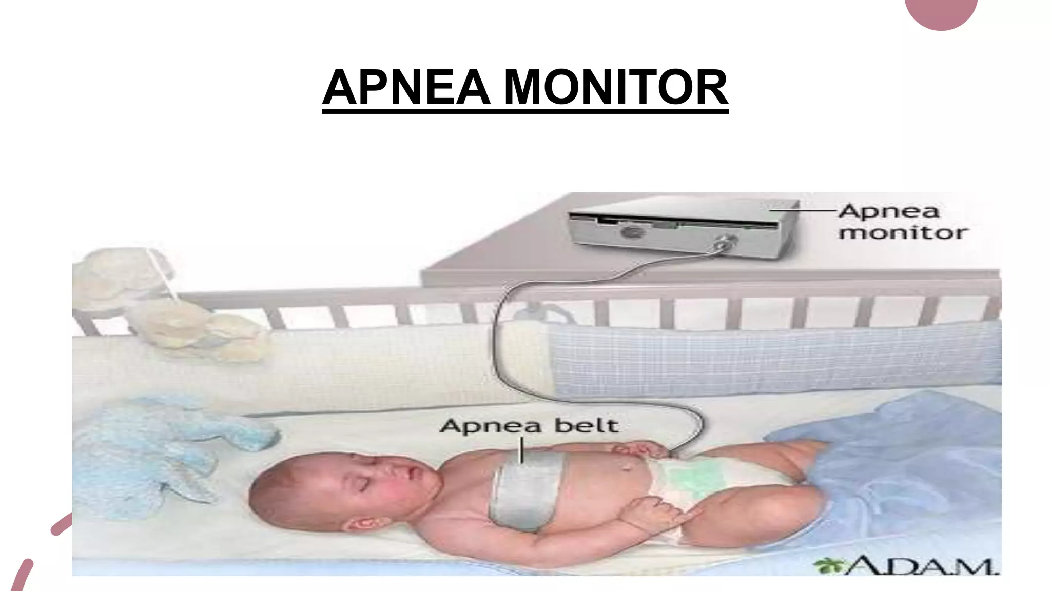 APNEA MONITOR
 