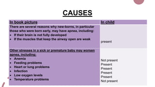 CAUSES
In book picture In child
There are several reasons why new-borns, in particular
those who were born early, may have apnea, including:
 If their brain is not fully developed
 If the muscles that keep the airway open are weak
present
Other stresses in a sick or premature baby may worsen
apnea, including:
 Anemia
 Feeding problems
 Heart or lung problems
 Infection
 Low oxygen levels
 Temperature problems
Not present
Present
Present
Present
Present
Not present
 