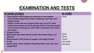 EXAMINATION AND TESTS
In book picture In child
 These babies will be placed on monitors in the hospital.
(The monitors keep track of their breathing, heart rate, and
oxygen levels.
Drops in heart rate and oxygen levels may occur for other
reasons than apnea (such as passing stool or moving around),
so the monitor tracings are most often reviewed by the health
care team.)
 Physical Exam
 Blood tests that check blood counts, electrolyte levels, and
infection
 Measurement of the levels of oxygen in the baby’s blood
 X-rays
 Apnea study, which monitors breathing effort, heart rate, and
oxygenation
Done
Done
Done
Done
Not done
Not done
 