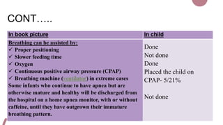 CONT…..
In book picture In child
Breathing can be assisted by:
 Proper positioning
 Slower feeding time
 Oxygen
 Continuous positive airway pressure (CPAP)
 Breathing machine (ventilator) in extreme cases
Some infants who continue to have apnea but are
otherwise mature and healthy will be discharged from
the hospital on a home apnea monitor, with or without
caffeine, until they have outgrown their immature
breathing pattern.
Done
Not done
Done
Placed the child on
CPAP- 5/21%
Not done
 