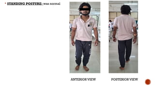 STANDING POSTURE- was normal
ANTERIOR VIEW POSTERIOR VIEW
 