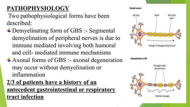 Case presentation on Guillain-Barré syndrom |neuromuscular disorder | PPTX