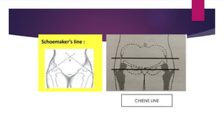 Case Presentation on Hip joint and clinical examination | PPTX