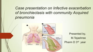 community acquired pneumonia