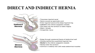 DIRECT AND INDIRECT HERNIA
 