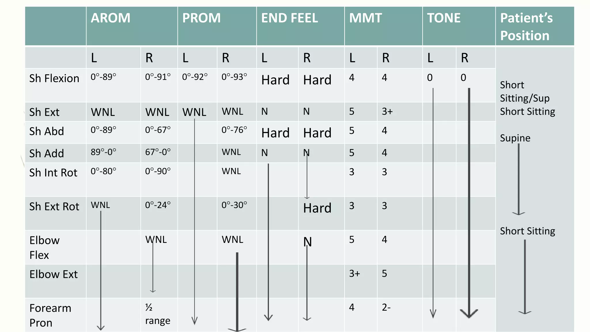 AROM PROM END FEEL MMT TONE Patient’s
Position
L R L R L R L R L R
Short
Sitting/Sup
Short Sitting
Supine
Short Sitting
Sh Flexion 0°-89° 0°-91° 0°-92° 0°-93° Hard Hard 4 4 0 0
Sh Ext WNL WNL WNL WNL N N 5 3+
Sh Abd 0°-89° 0°-67° 0°-76° Hard Hard 5 4
Sh Add 89°-0° 67°-0° WNL N N 5 4
Sh Int Rot 0°-80° 0°-90° WNL 3 3
Sh Ext Rot WNL 0°-24° 0°-30° Hard 3 3
Elbow
Flex
WNL WNL N 5 4
Elbow Ext 3+ 5
Forearm
Pron
½
range
4 2-
 