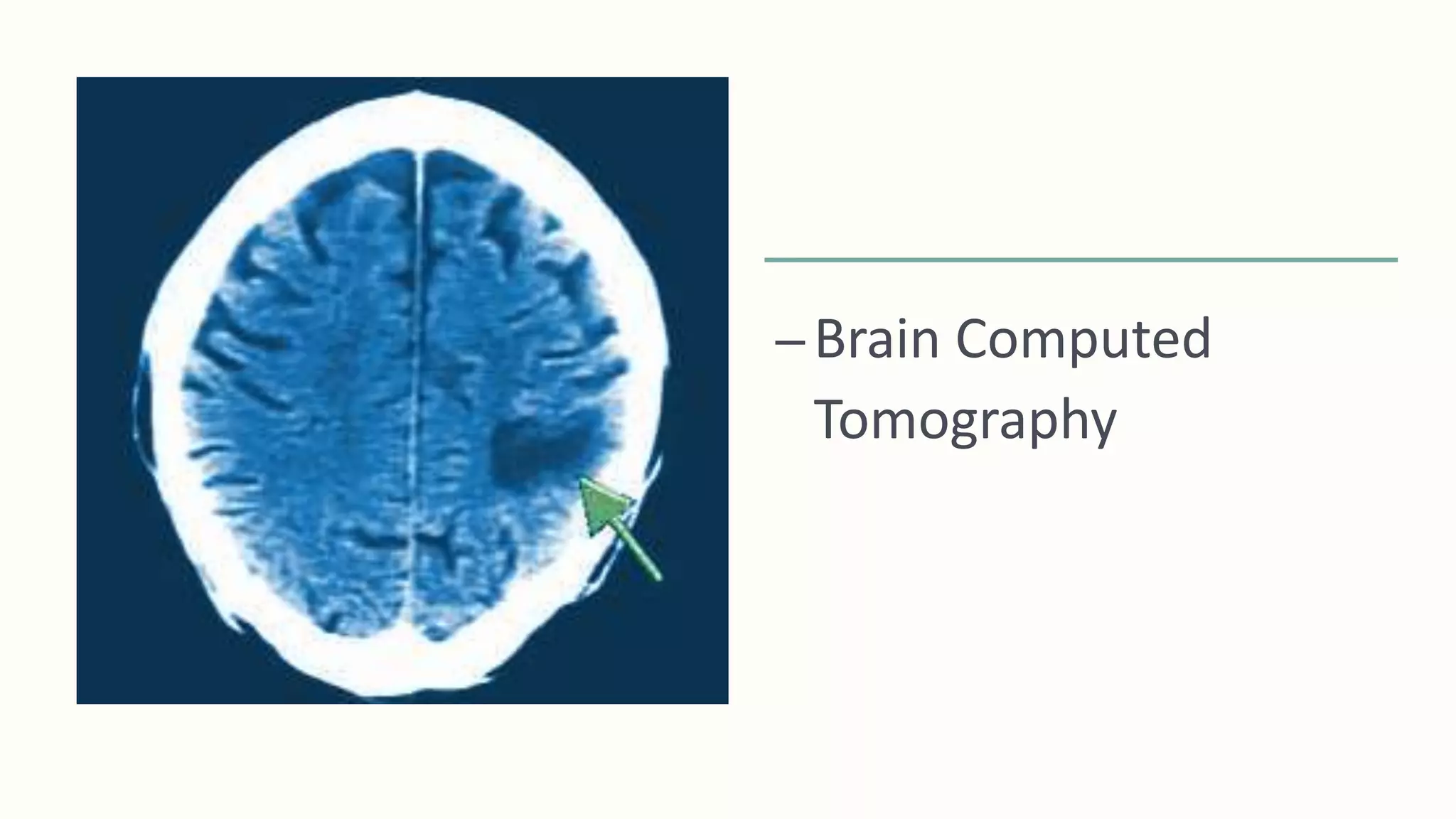 –Brain Computed
Tomography
 