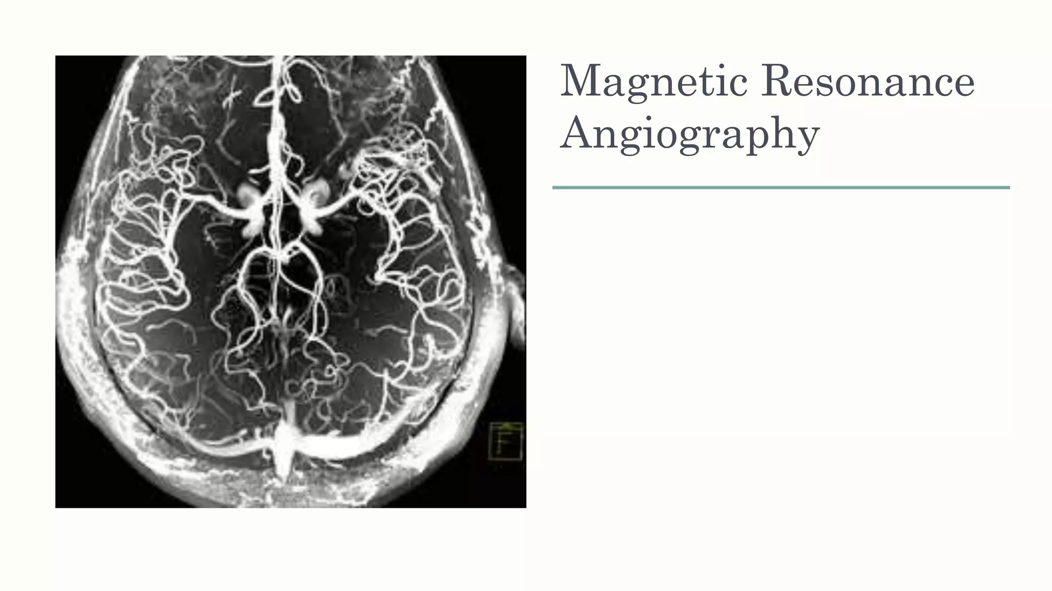 Magnetic Resonance
Angiography
 