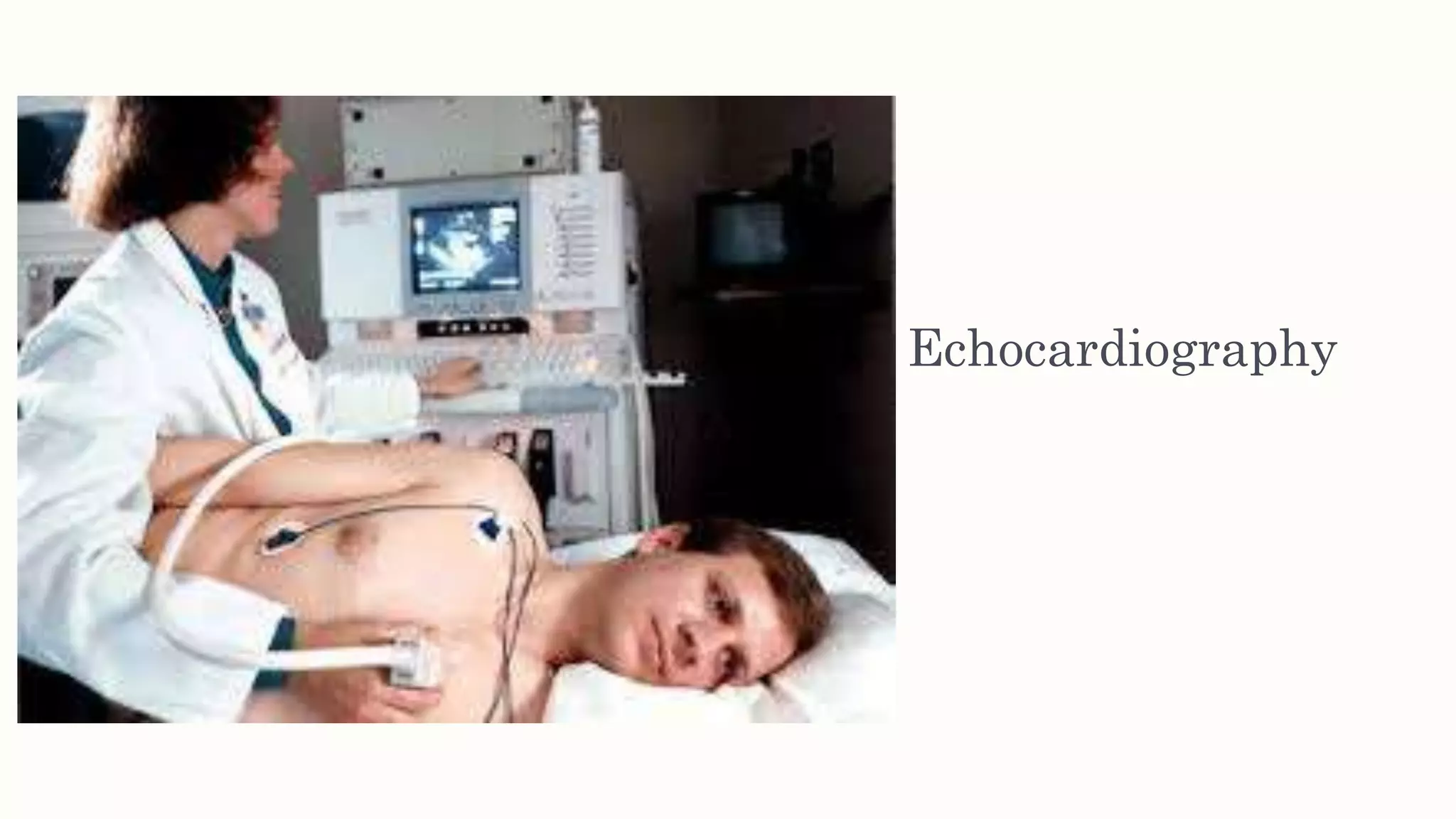 Echocardiography
 