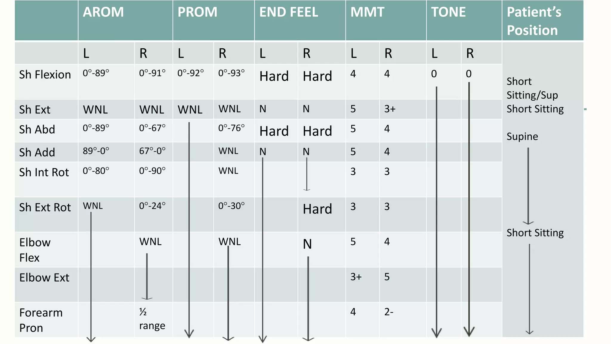 AROM PROM END FEEL MMT TONE Patient’s
Position
L R L R L R L R L R
Short
Sitting/Sup
Short Sitting
Supine
Short Sitting
Sh Flexion 0°-89° 0°-91° 0°-92° 0°-93° Hard Hard 4 4 0 0
Sh Ext WNL WNL WNL WNL N N 5 3+
Sh Abd 0°-89° 0°-67° 0°-76° Hard Hard 5 4
Sh Add 89°-0° 67°-0° WNL N N 5 4
Sh Int Rot 0°-80° 0°-90° WNL 3 3
Sh Ext Rot WNL 0°-24° 0°-30° Hard 3 3
Elbow
Flex
WNL WNL N 5 4
Elbow Ext 3+ 5
Forearm
Pron
½
range
4 2-
 