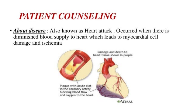 Pathophysiology of myocardial infarction pdf picture