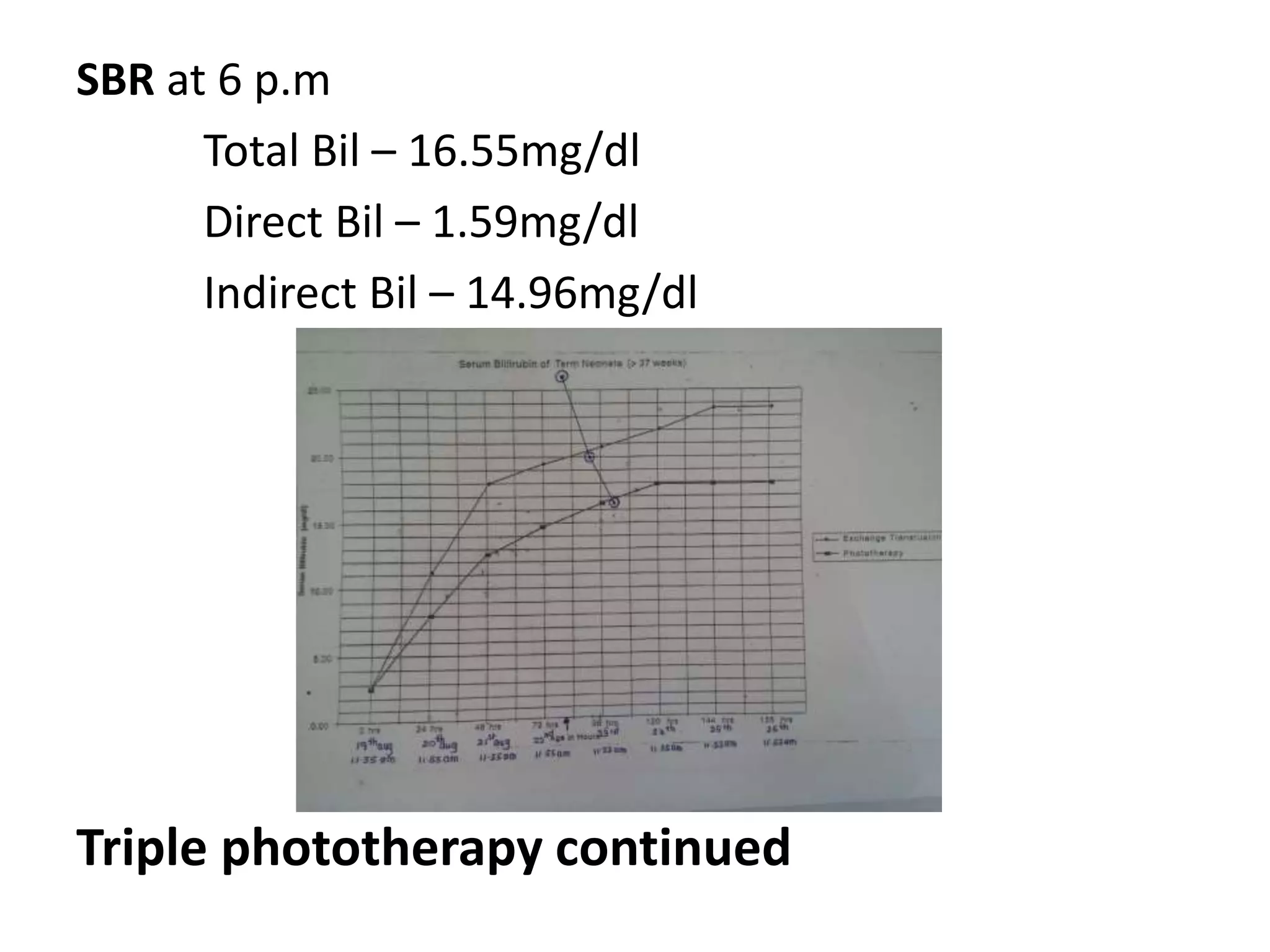 SBR at 6 p.m
Total Bil – 16.55mg/dl
Direct Bil – 1.59mg/dl
Indirect Bil – 14.96mg/dl
Triple phototherapy continued
 