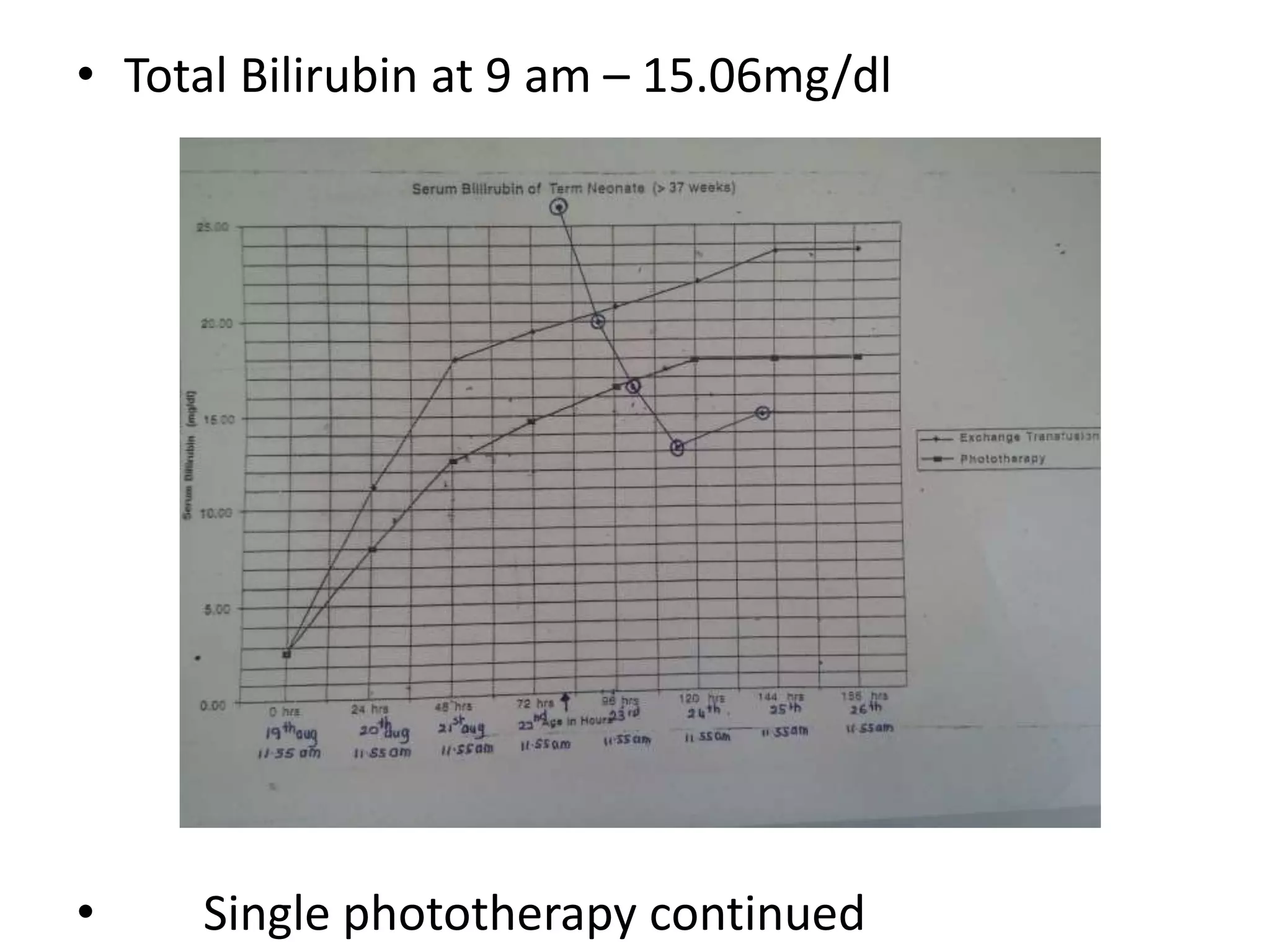 • Total Bilirubin at 9 am – 15.06mg/dl
• Single phototherapy continued
 