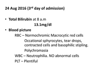 24 Aug 2016 (3rd day of admission)
• Total Bilirubin at 8 a.m
13.1mg/dl
• Blood picture
RBC – Normochromic Macrocytic red cells
Occational sphyrocytes, tear drops,
contracted cells and basophilic stipling.
Polychromasia
WBC – Neutrophilia. NO abnormal cells
PLT – Plentiful
 