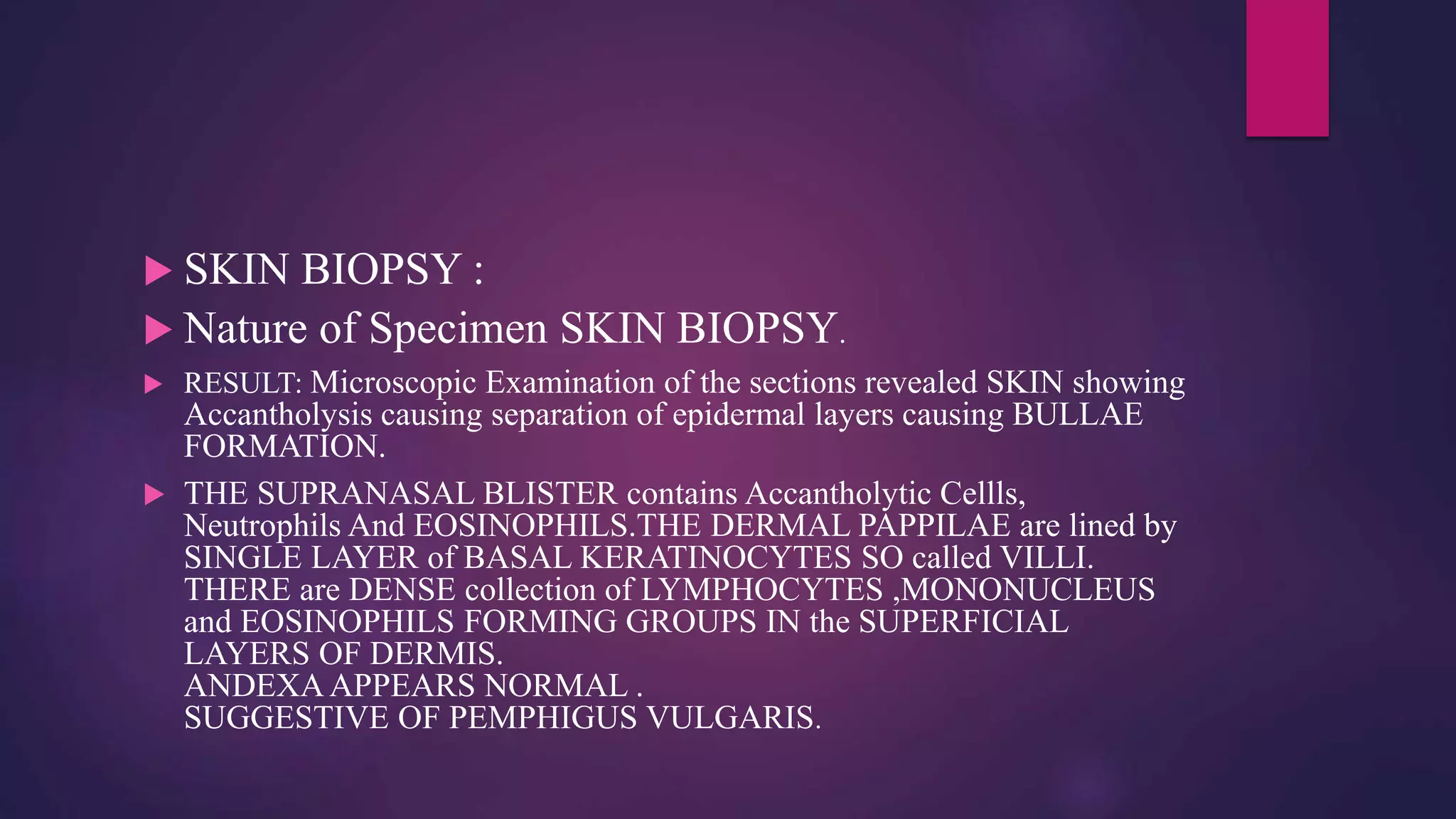  SKIN BIOPSY :
 Nature of Specimen SKIN BIOPSY.
 RESULT: Microscopic Examination of the sections revealed SKIN showing
Accantholysis causing separation of epidermal layers causing BULLAE
FORMATION.
 THE SUPRANASAL BLISTER contains Accantholytic Cellls,
Neutrophils And EOSINOPHILS.THE DERMAL PAPPILAE are lined by
SINGLE LAYER of BASAL KERATINOCYTES SO called VILLI.
THERE are DENSE collection of LYMPHOCYTES ,MONONUCLEUS
and EOSINOPHILS FORMING GROUPS IN the SUPERFICIAL
LAYERS OF DERMIS.
ANDEXA APPEARS NORMAL .
SUGGESTIVE OF PEMPHIGUS VULGARIS.
 