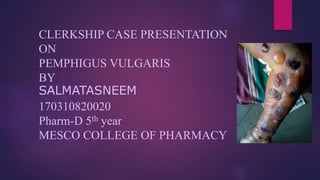 CLERKSHIP CASE PRESENTATION
ON
PEMPHIGUS VULGARIS
BY
SALMATASNEEM
170310820020
Pharm-D 5th year
MESCO COLLEGE OF PHARMACY
 