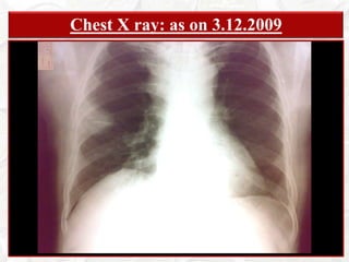 Pain in the back of neck… dull aching , aggravated by extremes of movement for last 14 days