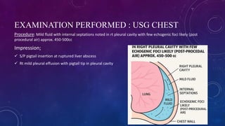CASE PRESENTATION ON RUPTURED LIVER ABCESS BY DR JESMINA KHATUN | PDF