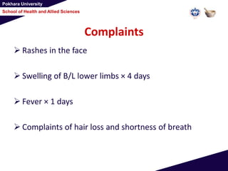 Pokhara University
School of Health and Allied Sciences
Complaints
 Rashes in the face
 Swelling of B/L lower limbs × 4 days
 Fever × 1 days
 Complaints of hair loss and shortness of breath
 