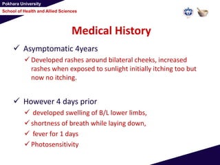Pokhara University
School of Health and Allied Sciences
Medical History
 Asymptomatic 4years
 Developed rashes around bilateral cheeks, increased
rashes when exposed to sunlight initially itching too but
now no itching.
 However 4 days prior
 developed swelling of B/L lower limbs,
 shortness of breath while laying down,
 fever for 1 days
 Photosensitivity
 