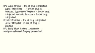 B/L Supra-Orbtial - 3ml of drug is injected.
Supra –Trochleae - 3ml of drug is
injected. Zygomatico Temporal - 3ml of drug
is injected. Auriculo Temporal - 3ml of drug
is injected.
Greater Occipital - 3ml of drug is injected.
Lesser Occipital – 2-3ml of drug is
injected.
B/L Scalp block is done . Adequate
analgesia achieved. Surgery proceeded.
 