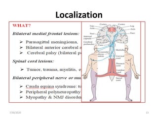 Localization
• Is it neurologic?
7/30/2020 13
 