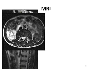 MRI
7/30/2020 15
 