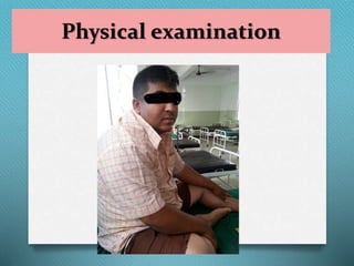 Physical examination
 
