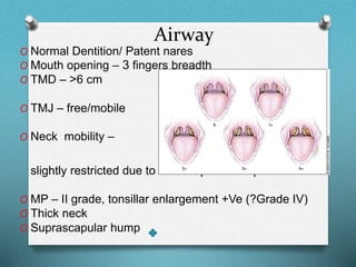 Airway
O Normal Dentition/ Patent nares
O Mouth opening – 3 fingers breadth
O TMD – >6 cm
O TMJ – free/mobile
O Neck mobility –
slightly restricted due to surascapular hump
O MP – II grade, tonsillar enlargement +Ve (?Grade IV)
O Thick neck
O Suprascapular hump
 