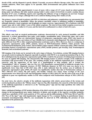 decade of life, and the diagnosis is purely clinical. Currently, no proven effective therapy exists. The cause of PSP
remains unknown. Most cases appear to be sporadic. Both environmental and genetic influences have been
postulated.
PSP is usually fatal within approximately 6 years of onset, with a range of 2-17 years, based on cohort patients
dying under surveillance; life table analysis among Golbe’s entire cohort [13,14,15,16] revealed a median disease
duration of 9.7 years. Conflicting reports exist regarding the influence of age at diagnosis on survival; Younger
patients usaully survive longer, although this is not a uniform finding among other studies [13,36]
The primary causes of death in patients with PSP are infections and pulmonary complications (eg, pneumonia) that
are frequently related to immobility. Often, the primary morbidity relates to imbalance leading to immobility,
although dementia, visual symptoms, and dysphagia are major concerns. Approximately 50% of patients with PSP
require some aid to walk within 3 years of the initial symptoms. The interval from initial symptom occurrence to
the need for a cane or a walker is 3.1 years, and the interval to confinement to a chair or bed is 8.2 years.
 Neuroimaging
This elderly man had an atypical parkinsonian syndrome characterized by early postural instability and falls
backward, a vertical supranuclear gaze palsy, axial rigidity, pseudobulbar palsy, frontal lobe signs, and a poor
response to L-dopa. These are characteristic features of progressive supranuclear palsy (PSP), also known as
Richardson disease. It has a prevalence of 5 per 100,000, but is commonly underdiagnosed. The clinical features are
quite different from PD or other atypical parkinsonian syndromes such as MSA. However, there is a subgroup of
progressive supranuclear palsy (PSP), patients, known as PSP-Parkinsonism (PSP-P), which presents with
asymmetrical bradykinesia, jerky tremor, and an initial L-dopa response without vertical gaze palsy. Other unusual
presenting features of progressive supranuclear palsy (PSP), include primary gait freezing, early frontotemporal
dementia, and corticobasal syndrome.
MR imaging of the brain can be normal in the early stages of disease. Nevertheless, certain MR imaging features
can greatly assist in making the diagnosis especially in patients with PSP-P or an atypical presentation (Fig. 6). The
first radiological clue for progressive supranuclear palsy (PSP), would be the presence of striking hyperextension of
the neck on sagittal MR imaging. The characteristic MR imaging feature is selective atrophy of the midbrain in
association with preservation of the pons. The resulting atrophy of the midbrain tegmentum gives a distinctive
concavity with the appearance of the beak of a hummingbird or king penguin, and is termed the
“hummingbird” [48] or “penguin” sign (see Fig. 6A). [49] Quantitative measurements of midbrain atrophy have
been shown to improve diagnostic accuracy of PSP. Midbrain diameter in PSP (13.4 mm) was shown to be
significantly lower than that of PD (18.5 mm). [48] A study indicated that the surface area of midbrain of
progressive supranuclear palsy (PSP), (56 mm2) was significantly smaller than that of Parkinsonian subtype of
MSA (MSA-P) (97.2 mm2), PD (103 mm2), and healthy controls (117 mm2). Some overlaps of the area
measurements were observed in PSP and Parkinsonian subtype of MSA (MSA-P), but the ratio of the area of the
midbrain to pons was significantly smaller in PSP when compared with Parkinsonian subtype of MSA (MSA-P).
[49]
On axial views, the selective atrophy of the midbrain tegmentum with relative preservation of the tectum and
cerebral peduncles produces the “Mickey mouse” sign (see Fig. 6B). Sometimes, the concavity of the lateral margin
of the midbrain tegmentum is referred to as the “morning glory” sign and has high specificity but rather low
sensitivity for PSP.
Other radiological findings of PSP include dilatation of the third ventricle, particularly the posterior portion, signal
change in the periaqueductal gray matter indicative of gliosis, and atrophy of the superior cerebellar peduncle,
which has a specificity of 94% and sensitivity of 74% and can aid the differentiation of PSP from MSA-P and PD.
[51] “Eye of the tiger” sign with hypointensity signal change in T2, a common finding in pantothenate kinase-
associated neurodegeneration (PKAN), can occasionally be observed in PSP, indicating the presence of iron
deposition in the putamen.[52]
 Addendum
 A new version of this PDF file (with a new case) is uploaded in my web site every week (every Saturday and
 