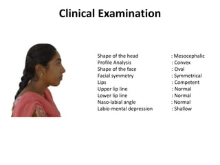 Clinical Examination
Shape of the head : Mesocephalic
Profile Analysis : Convex
Shape of the face : Oval
Facial symmetry : Symmetrical
Lips : Competent
Upper lip line : Normal
Lower lip line : Normal
Naso-labial angle : Normal
Labio-mental depression : Shallow
 