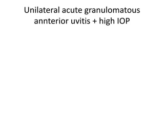 Unilateral acute granulomatous
annterior uvitis + high IOP
 
