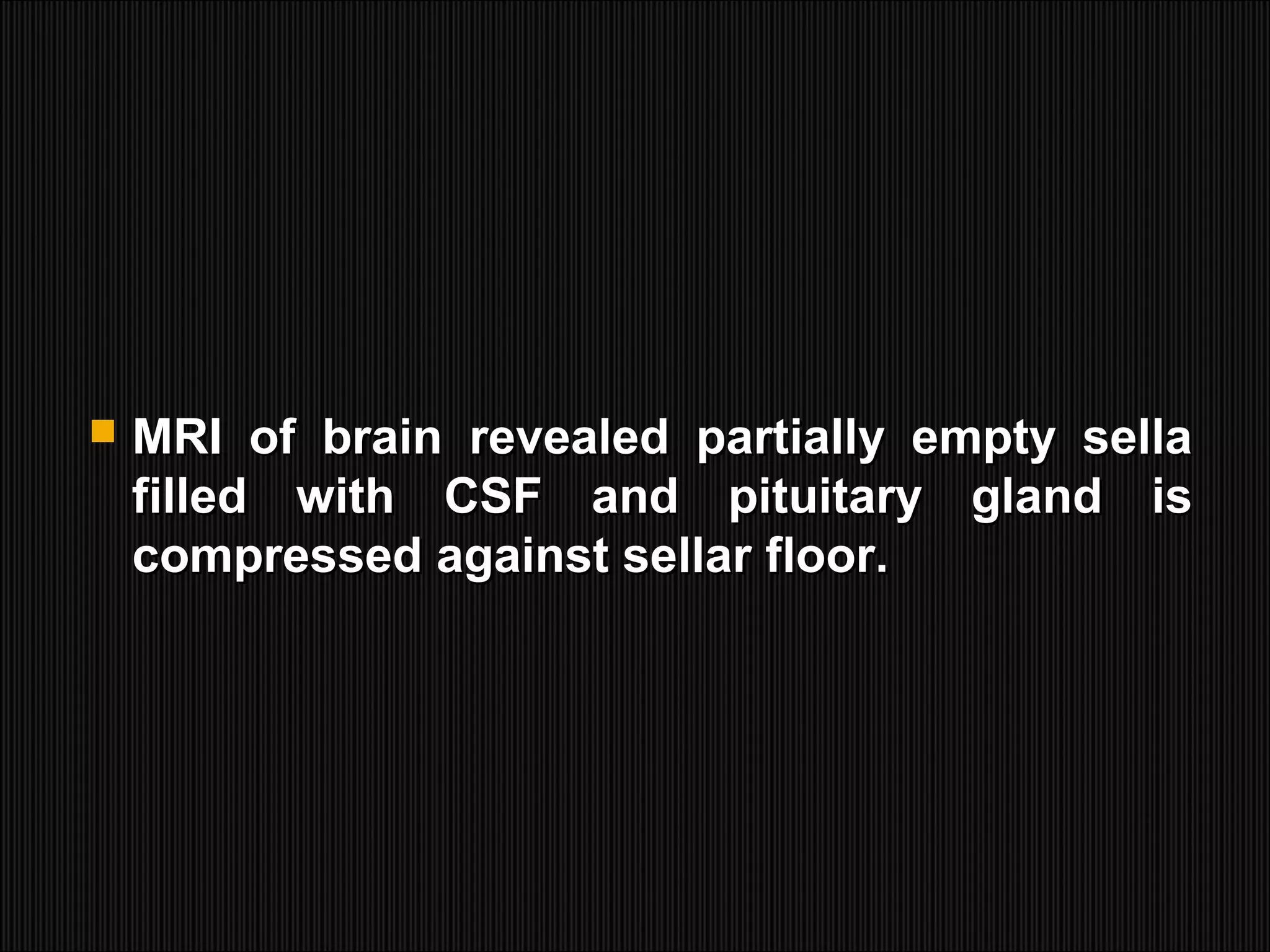  MRI of brain revealed partially empty sellaMRI of brain revealed partially empty sella
filled with CSF and pituitary gland isfilled with CSF and pituitary gland is
compressed against sellar floor.compressed against sellar floor.
 