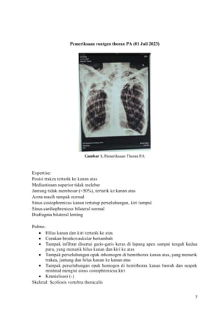 Hasil Rontgen Thorax Case report Aulia.docx