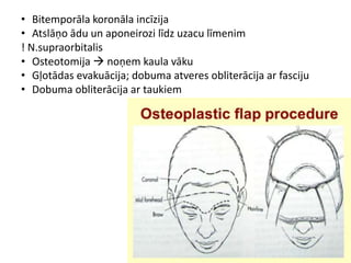 • Bitemporāla koronāla incīzija
• Atslāņo ādu un aponeirozi līdz uzacu līmenim
! N.supraorbitalis
• Osteotomija  noņem kaula vāku
• Gļotādas evakuācija; dobuma atveres obliterācija ar fasciju
• Dobuma obliterācija ar taukiem
 