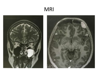 MRI
 