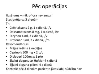 Pēc operācijas
Uzsējums – mikroflora nav augusi
Stacionēta uz 3 dienām
Th:
• Ceftriaksons 2 g, 1 x dienā, i/v
• Deksametazons 8 mg, 1 x dienā, i/v
• Dicynon 4 ml, 3 x dienā, i/v
• Profenac 3 ml, 2 x dienā, i/m
Rekomendācijas:
• Mājas režīms 2 nedēļas
• Ciprinols 500 mg x 2 p/o
• Dicloberl 100mg x 1 p/o
• Skalot degunu ar HuMer 4 x dienā
• Eļļaini deguna pilieni 4 x dienā
Kontrolē pēc 3 dienām paciente jūtas labi, sūdzību nav
 