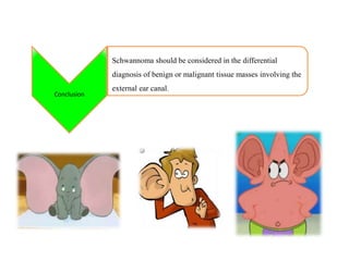 Schwannoma should be considered in the differential
diagnosis of benign or malignant tissue masses involving the
external ear canal.
Conclusion
 