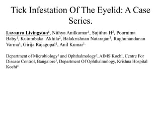Tick Infestation Of The Eyelid: A Case
Series.
Lavanya Livingston1, Nithya Anilkumar1, Sujithra H2, Poornima
Baby1, Kutumbaka Akhila2, Balakrishnan Natarajan3, Raghunandanan
Varma4, Girija Rajagopal1, Anil Kumar1.
Department of Microbiology1 and Ophthalmology2, AIMS Kochi, Centre For
Disease Control, Bangalore3, Department Of Ophthalmology, Krishna Hospital
Kochi4
 