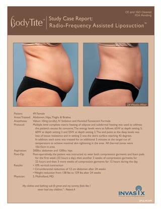CE and ISO Cleared
                                                                                                      FDA Pending
                               Study Case Report:
                               Radio-Frequency Assisted Liposuction ™




                                                                                                  24 Weeks After

Patient:         49 Female
Areas Treated:   Abdomen, Hips, Thighs & Braline
Anesthesia:      Valium 10mg (orally), IV Sedation and Hunstad Tumescent Formula
Protocol:        Multiple level complete matrix heating of adipose and subdermal heating was used to address
                    the patient’s excess fat concerns. The energy levels were as follows: 65W at depth setting 5,
                    60W at depth setting 3 and 55W at depth setting 2. The end point at the deep levels was
                    loss of tissue resistance and in setting 2 was the skin’s surface reaching 42 degrees.
                    In addition, each zone was treated for an additional 3 minutes at the target cut of
                    temperature to achieve maximal skin tightening in the area. All thermal zones were
                    10x15cm in area.
Aspiration:      2000cc abdomen and 1200cc hips
Post-Op:         Post-operatively, the patient was instructed to wear both compression garments and foam pads
                    for the ﬁrst week (22 hours a day), then another 2 weeks of compression garments for
                    22 hours and then 3 more weeks of compression garments for 12 hours during the day.
Results:         • 10% vertical contraction
                 • Circumferential reduction of 12 cm abdomen after 24 weeks
                 • Weight reduction from 138 lbs to 129 lbs after 24 weeks
Physician:       S. Mulholland, MD


       My clothes and bathing suit ﬁt great and my tummy feels like I
                    never had any children.” - Patient A


                                                                                                            SM.6.49.AM
 