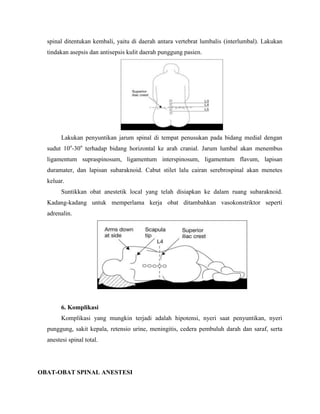 spinal ditentukan kembali, yaitu di daerah antara vertebrat lumbalis (interlumbal). Lakukan
tindakan asepsis dan antisepsis kulit daerah punggung pasien.

Lakukan penyuntikan jarum spinal di tempat penusukan pada bidang medial dengan
sudut 10o-30o terhadap bidang horizontal ke arah cranial. Jarum lumbal akan menembus
ligamentum supraspinosum, ligamentum interspinosum, ligamentum flavum, lapisan
duramater, dan lapisan subaraknoid. Cabut stilet lalu cairan serebrospinal akan menetes
keluar.
Suntikkan obat anestetik local yang telah disiapkan ke dalam ruang subaraknoid.
Kadang-kadang untuk memperlama kerja obat ditambahkan vasokonstriktor seperti
adrenalin.

6. Komplikasi
Komplikasi yang mungkin terjadi adalah hipotensi, nyeri saat penyuntikan, nyeri
punggung, sakit kepala, retensio urine, meningitis, cedera pembuluh darah dan saraf, serta
anestesi spinal total.

OBAT-OBAT SPINAL ANESTESI

 