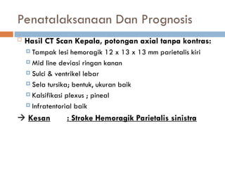 Penatalaksanaan Dan Prognosis
 Hasil CT Scan Kepala, potongan axial tanpa kontras:
 Tampak lesi hemoragik 12 x 13 x 13 mm parietalis kiri
 Mid line deviasi ringan kanan
 Sulci & ventrikel lebar
 Sela tursika; bentuk, ukuran baik
 Kalsifikasi plexus ; pineal
 Infratentorial baik
 Kesan : Stroke Hemoragik Parietalis sinistra
 