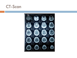 CT-Scan
 