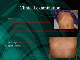Clinical examination
• GPE:
– Multiple café au lait macules over abdomen and
back (each 1-3 cm)
– Subcutaneous swellings over left parietal region and left sub mandibular region
- ? Neurofibromas
• PR – large, firm pelvic mass
• Spine - normal
 