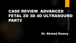 Case review  advanced fetal 2 d 3d 4d ultrasound part2