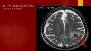 Case review ct mri brain part 4 dr ahmed esawy